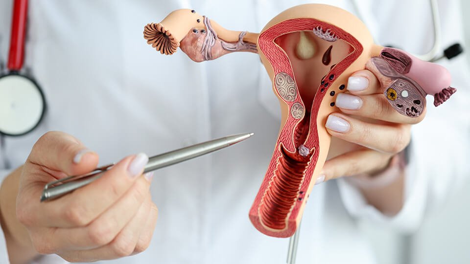 Cirurgia Ginecológica